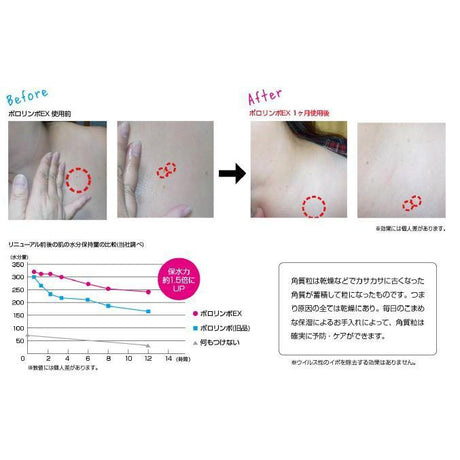 角質粒對策 Pororimbo EX加強版精華液 - 富士通販